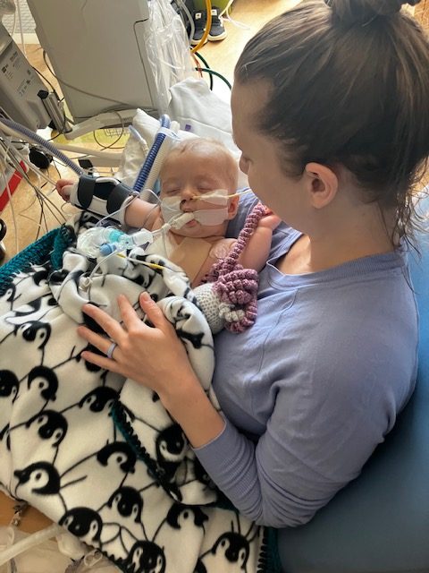 A mother holds her baby daughter. The daughter has a feeding tube in her nose as well as a tube in her mouth.